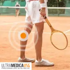 Naderwanie mięśnia brzuchatego łydki, łydka tenisisty