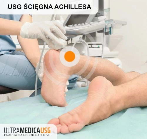 USG Achillesa - głowica aparatu USG przyłożona do stopy